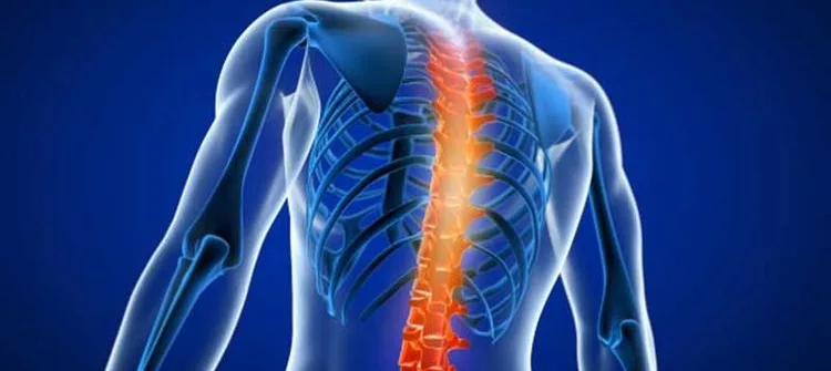 Cervical Spondylosis & Ayurvedic Treatment: Holistic Healing for Neck Pain