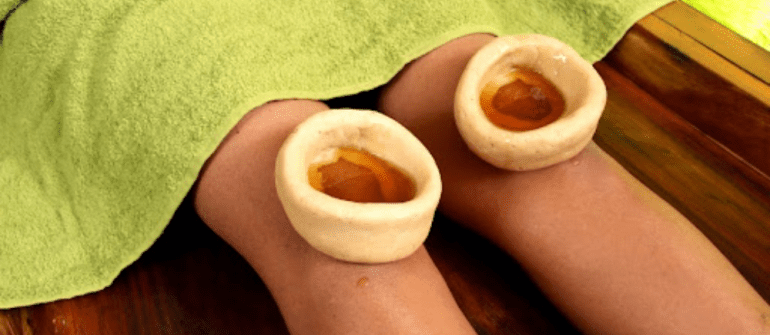 Janu Basti at Home: Ayurvedic Care for Knee Pain and Arthritis