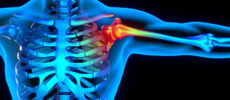 Frozen Shoulder at Home: How Ayurveda Provides Gentle Relief Without Surgery