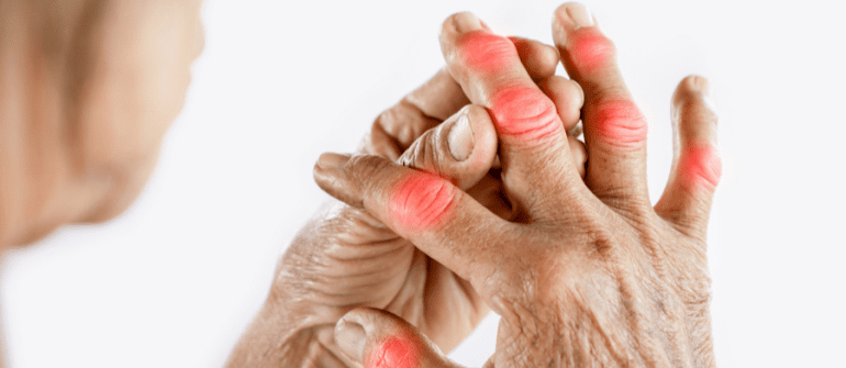 Osteoarthritis Treatment in Chennai at Home | Ayurvedic Joint Pain Relief