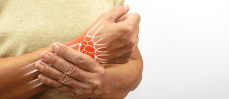 How Ayursh Offers the Best Arthritis Treatment at Home in Hyderabad